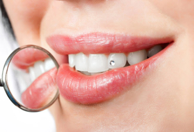 اختيار الأسنان الاصطناعية